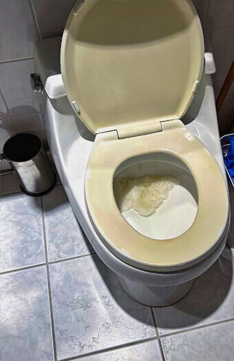 https://blockeddrainsmounthawthorn.com.au/uploads/2025/07/blocked-toilet-27293.jpg